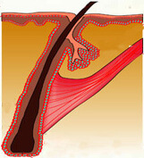 Hair Transplant Guwahati