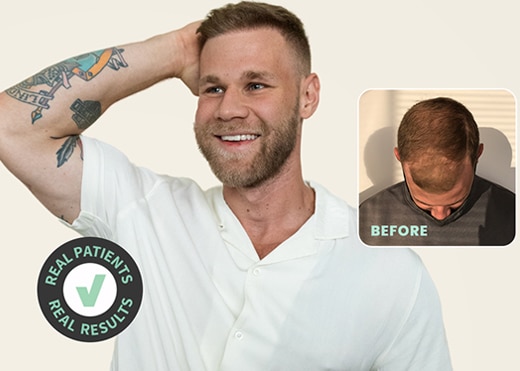 HAIR TRANSPLANT CHICAGO FROM SOLVE CLINICS