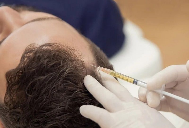 Harley Street Hair Transplant London clinic