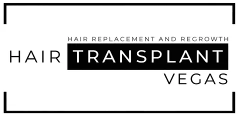 Hair Transplant Vegas
