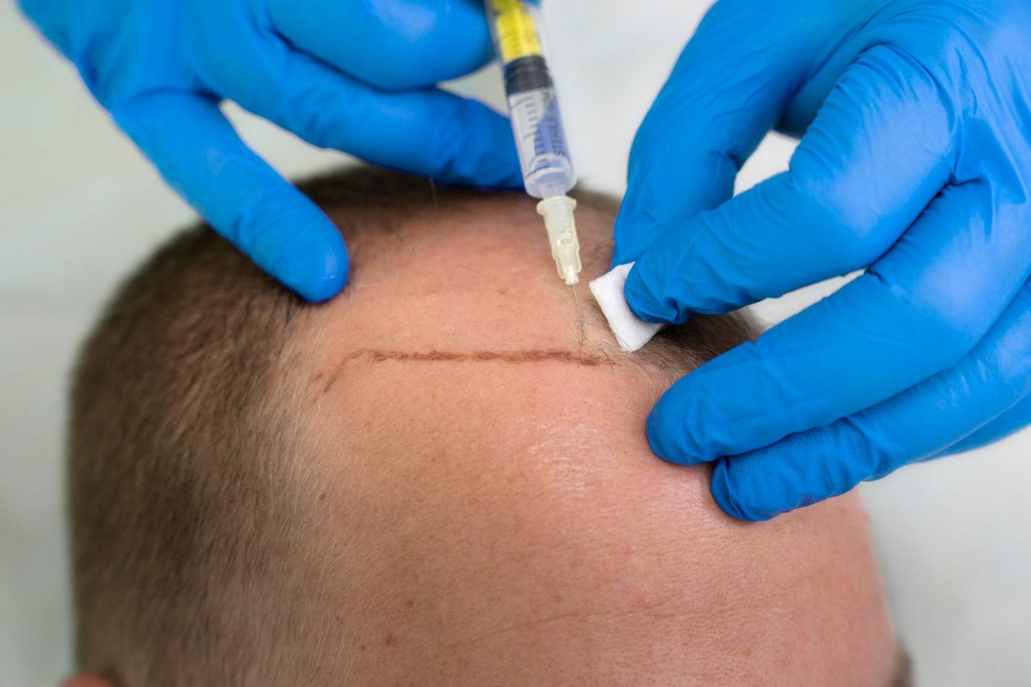 The Hair Transplant Center Dallas clinic in Dallas, United States
