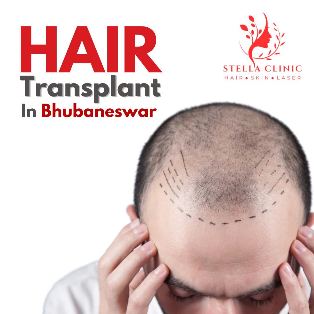 Stella Hair And Skin Clinic